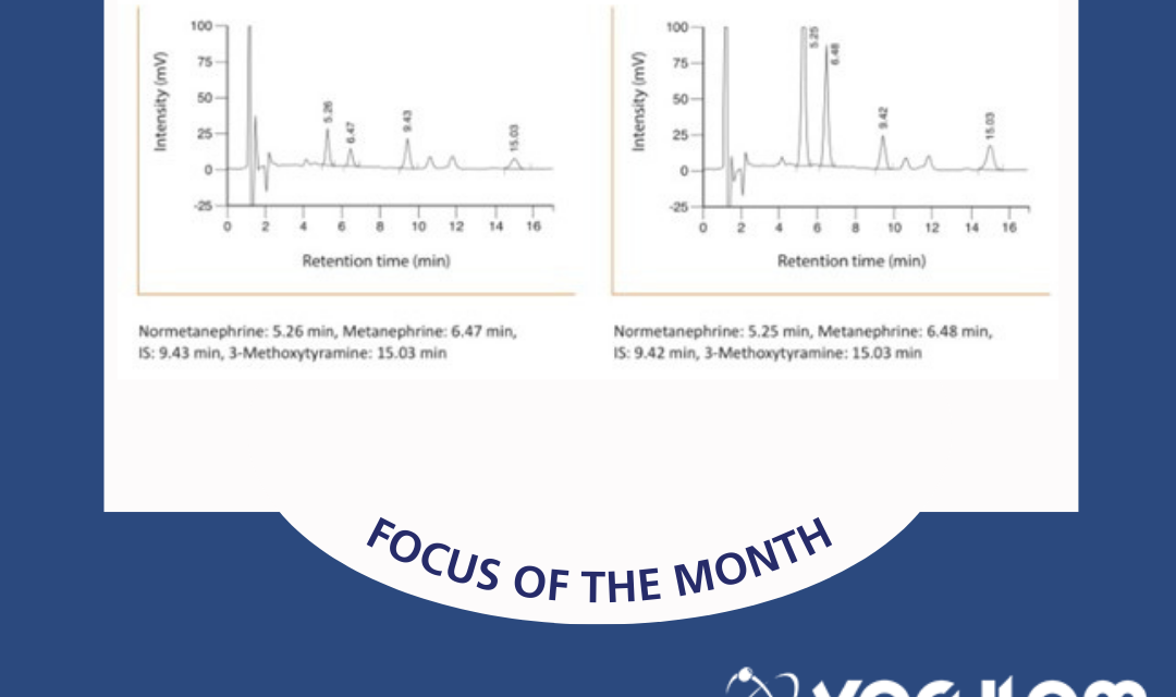 RECIPE Chemicals + Instruments GmbH – Metanephrine HPLC application (2)